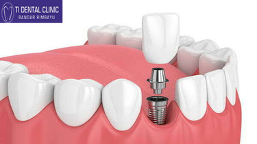 Beyond Braces: The Latest Innovations in Pediatric Dentistry